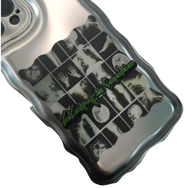 Metallic X-ray case