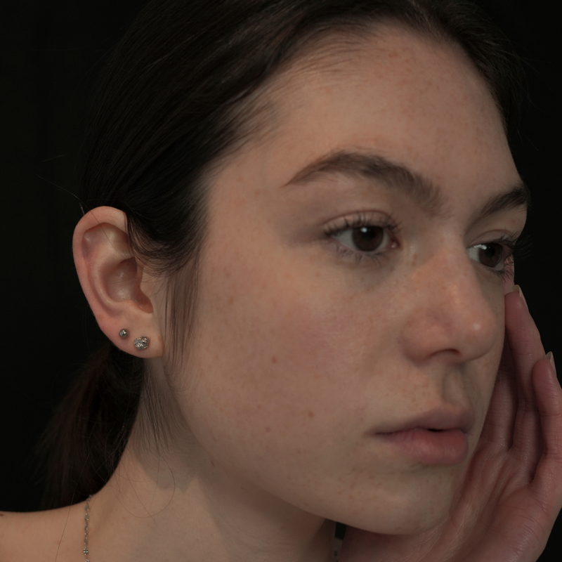 surgical pierce