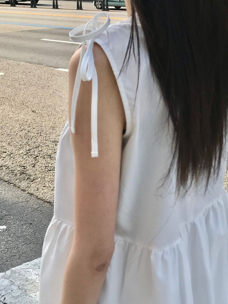 Melanie ops